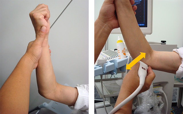 図　肘関節の観察法　前方アプローチの基本肢位とプローブワーク