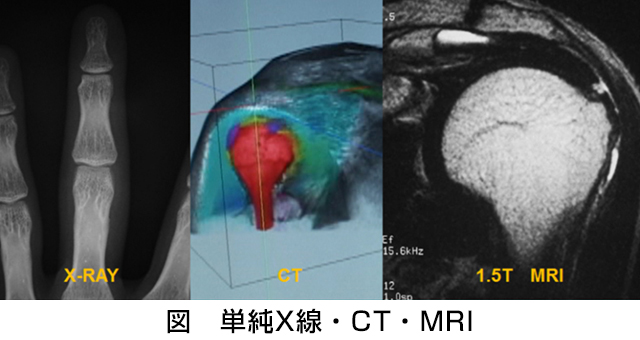 単純X線・CT・MRI