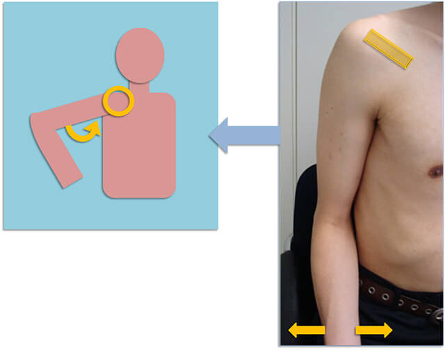 図　肩関節の観察法　烏口肩峰靭帯の観察の基本肢位