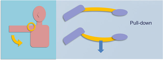 図　烏口肩峰靭帯の内転に伴うpull-down現象