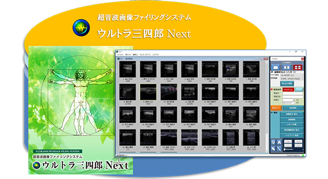 (株)エス・エス・ビー、使いやすさと高機能を追求した柔道整復師向け超音波画像ファイリングシステム「ウルトラ三四郎Next」を発表