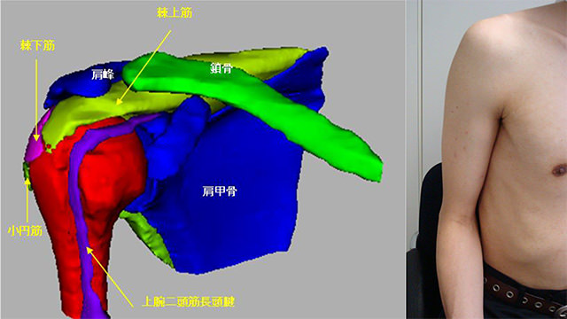 図　肩関節の観察法　肩関節の基本解剖　　基本肢位は座位