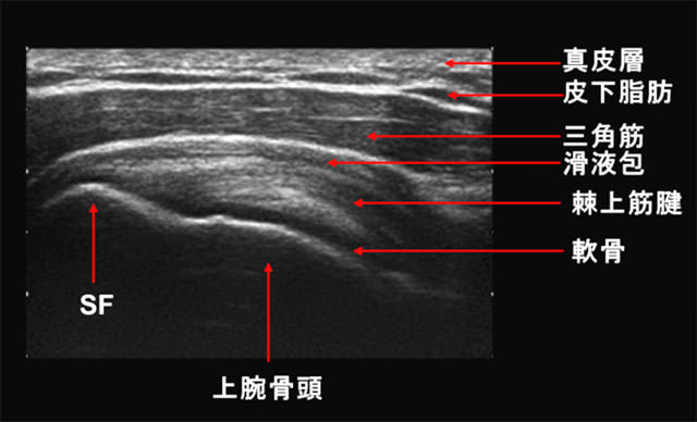 図　棘上筋腱の超音波画像の解剖