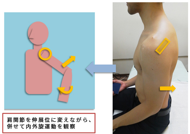 図　肩関節の観察法　棘下筋を中心に後方アプローチの基本肢位