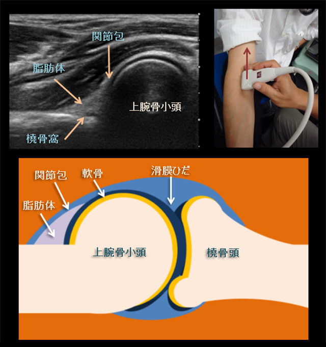 図　肘関節の観察法　前方アプローチ　長軸画像　やや近位