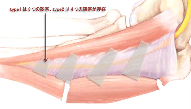 図　Osborne‘s ligament 28検体で調査　膜の中に靭帯