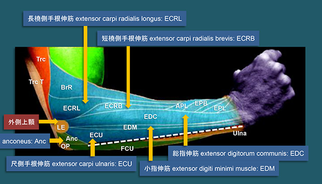 図　上腕骨外側上顆に付着する伸筋群