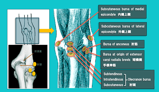 図　肘関節周囲の滑液包