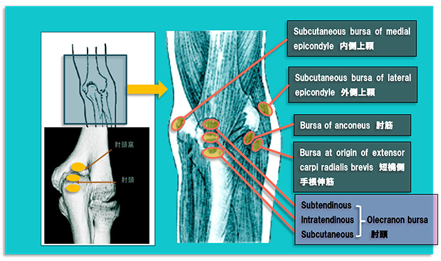 図　肘関節周囲の滑液包