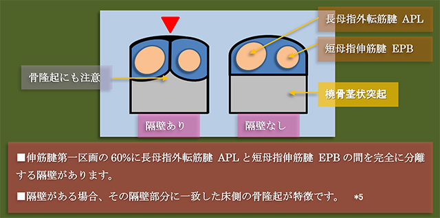 図　背側伸筋支帯の第1区画の隔壁