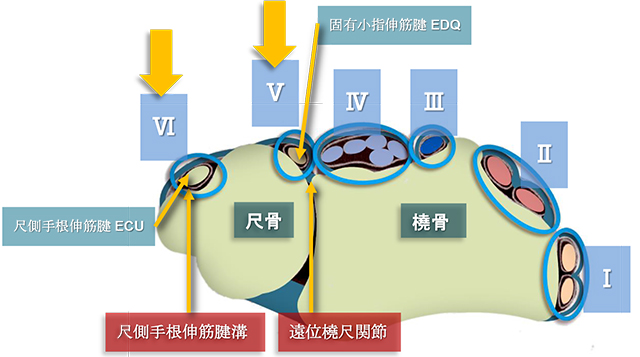 図　背側伸筋支帯の第5・6区画