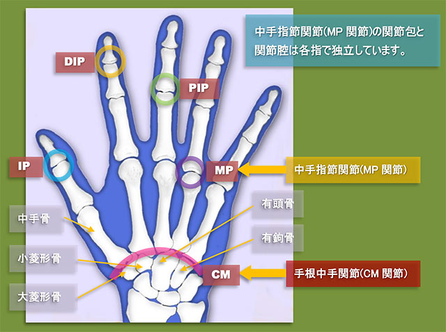 図　手根中手関節(CM関節)と中手指節関節(MP関節)