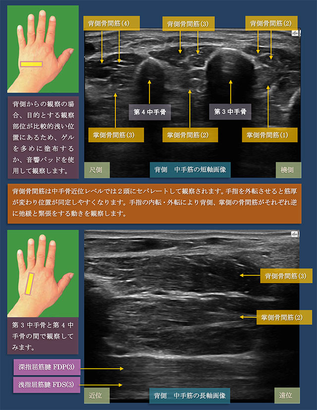 図　背側からの中手筋の短軸・長軸での超音波観察法