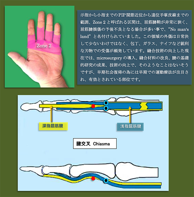 図　No man's land  Zone 2 誰も触ってはいけない部位？