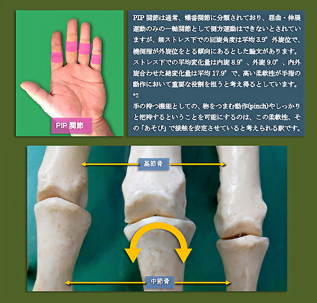 図　PIP関節　関節面の形状