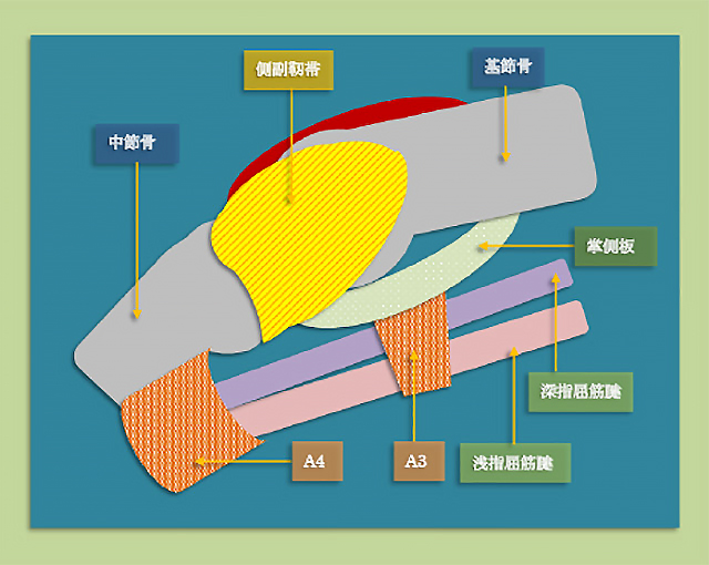 図　PIP関節の側副靭帯の概略図