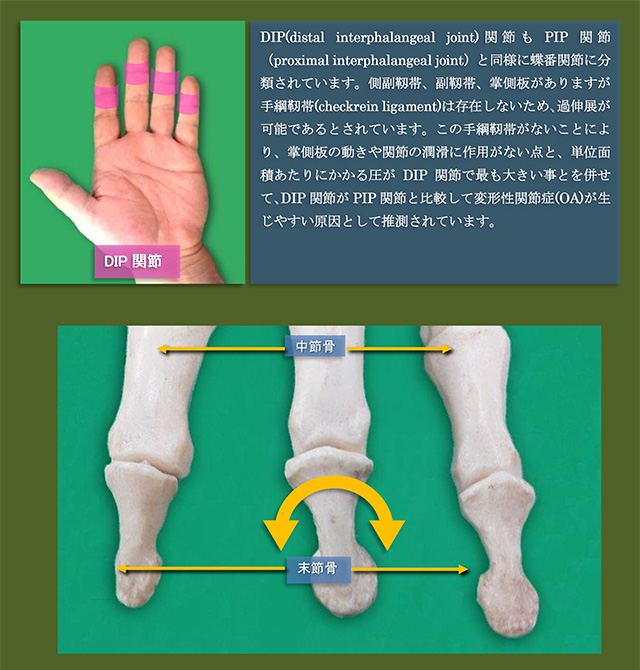 図　DIP関節　関節の位置と骨標本の画像