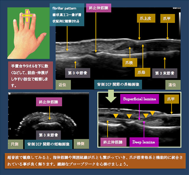 図　背側からのDIP関節の超音波観察法(長軸・短軸)