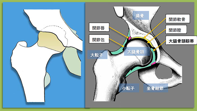 図　股関節の解剖　寛骨臼への収まりと大腿骨頭靱帯