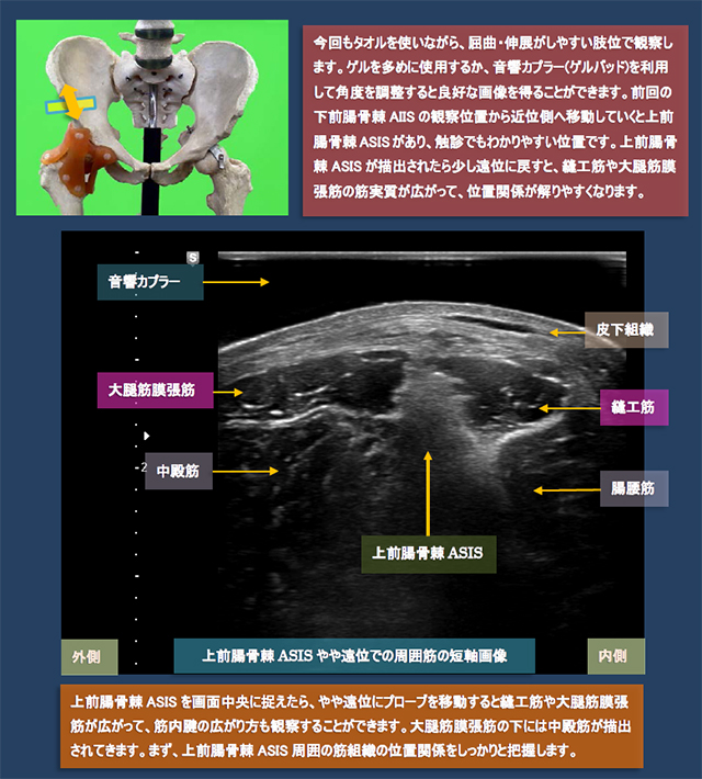 図　股関節前方の超音波観察法
上前腸骨棘AIIS周辺筋の短軸画像