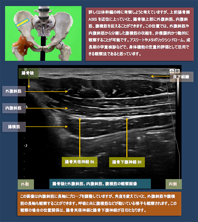 図　腸骨稜と外腹斜筋、内腹斜筋、腹横筋の観察