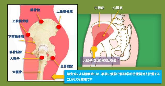 図　股関節外側の解剖と触診位置