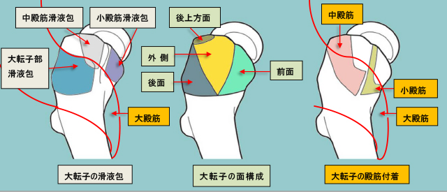 図　大転子の面構成(facet)と滑液包