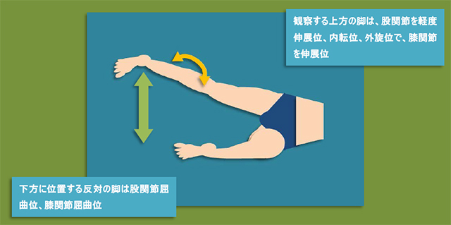 図　股関節外側の超音波観察法
大腿筋膜張筋の観察肢位の注意点