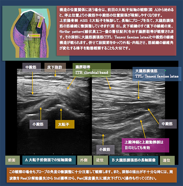 図　股関節外側の超音波観察法
大腿筋膜張筋と中殿筋、小殿筋、腸脛靭帯