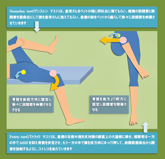 図　仙腸関節の徒手検査法(Gaenslen testゲンスレン テスト、Patric testパトリック テスト)